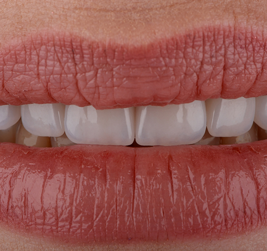 Close up of teeth visible between lips