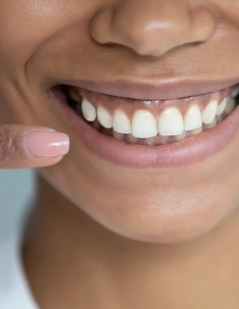 Close up of woman pointing to her smile