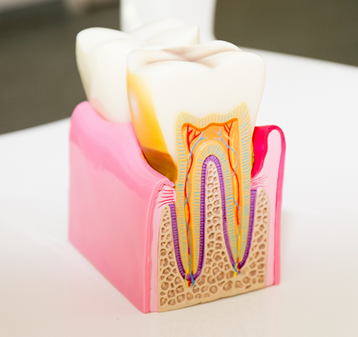 Model showing inside of tooth